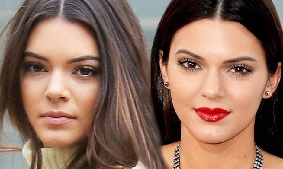 Kendall Jenner Before and After
